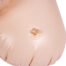 Close-up of a circular clear inflation valve embedded in a peach-colored silicone surface (likely on a medical training mannequin).